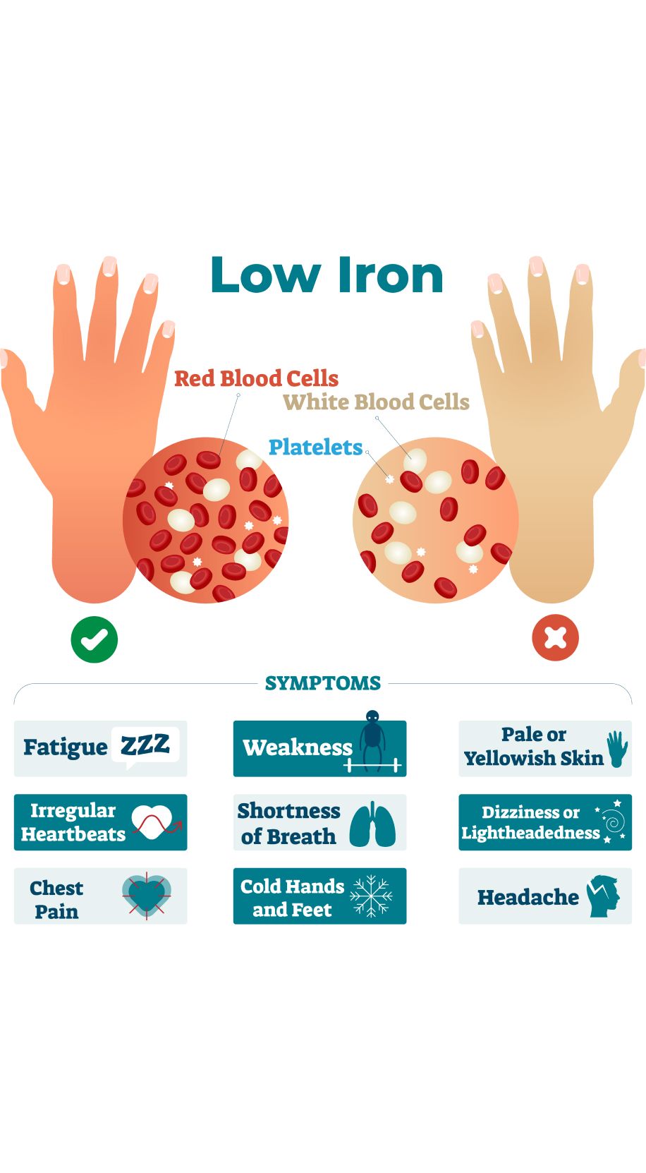 Low iron symptoms