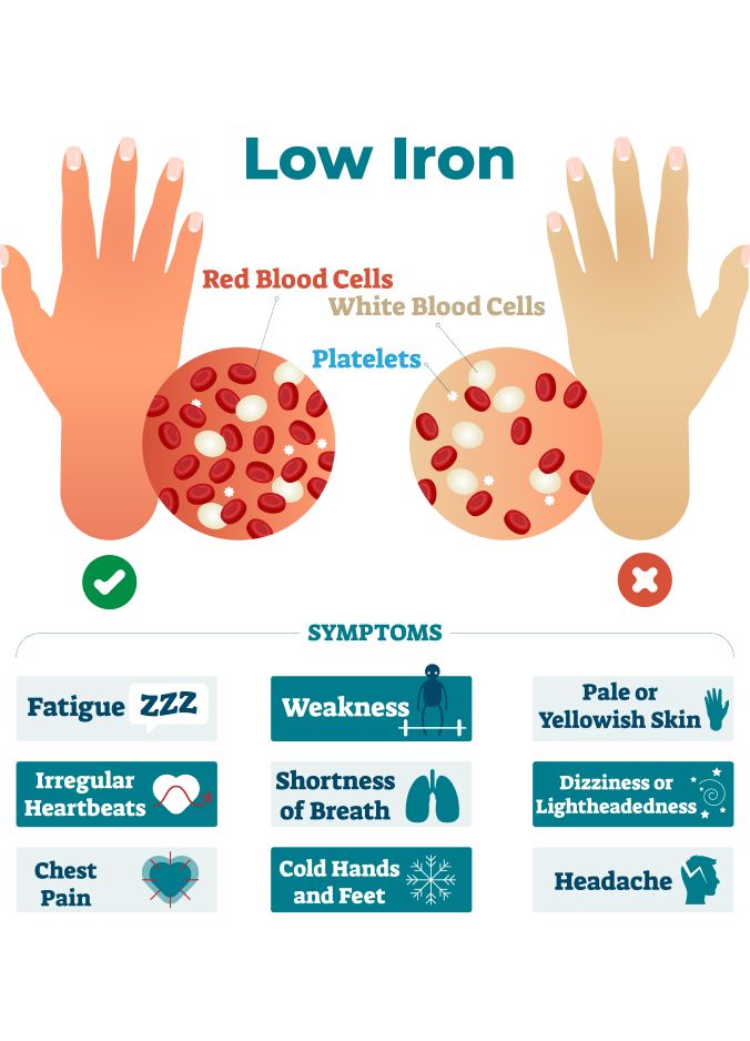 Low iron symptoms
