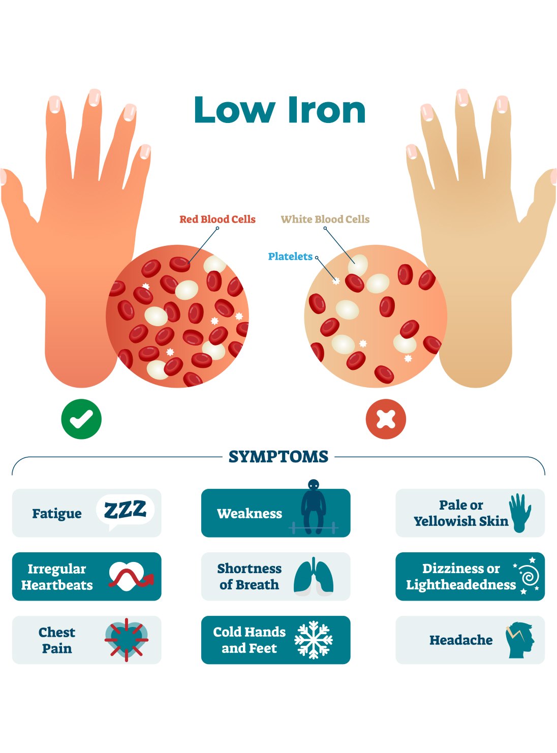Low iron symptoms