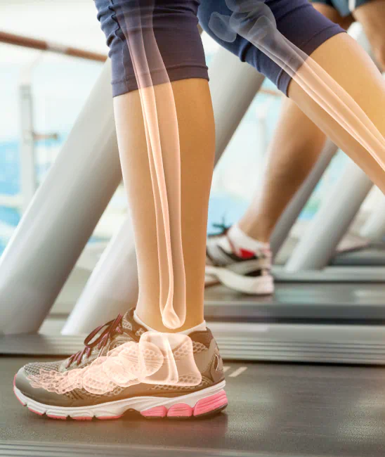 Walking on treadmill