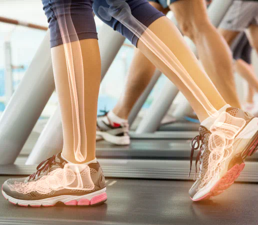 Walking on treadmill