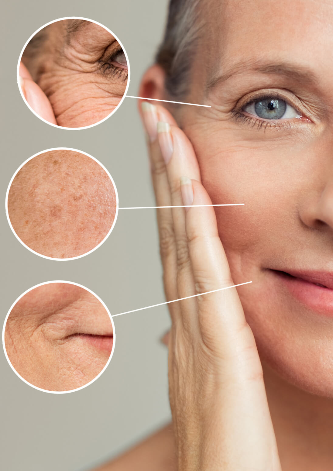 aging skin