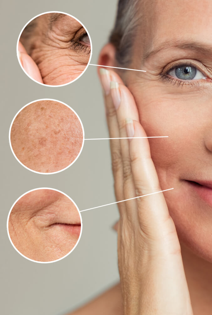 aging skin